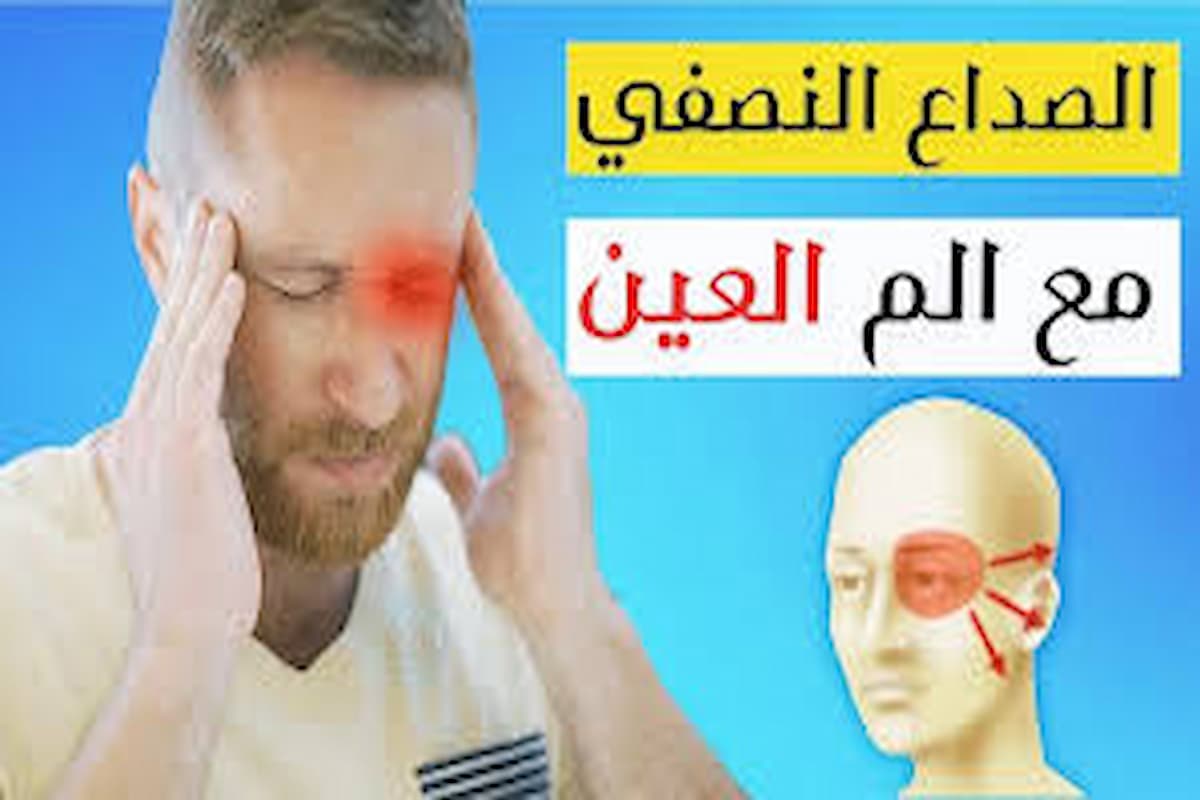 اسباب الصداع النصفي